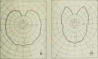 An illustration from Light and lighting (1908)