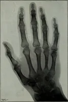 Picture 121 of 127 from Light visible and invisible : a series of lectures delivered at the Royal Institution of Great Britain, at Christmas, 1896 (1897), leaf 305