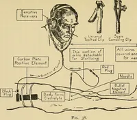 An illustration from Localization by X-rays and stereoscopy (1916)