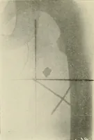 An illustration from Localization by X-rays and stereoscopy (1916)