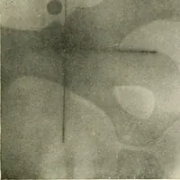 An illustration from Localization by X-rays and stereoscopy (1916)