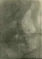 An illustration from Localization by X-rays and stereoscopy (1916)