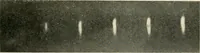 An illustration from Localization by X-rays and stereoscopy (1916)