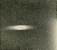 An illustration from Localization by X-rays and stereoscopy (1916)