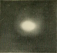 An illustration from Localization by X-rays and stereoscopy (1916)
