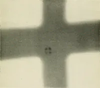An illustration from Localization by X-rays and stereoscopy (1916)