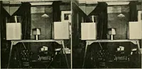 An illustration from Localization by X-rays and stereoscopy (1916)