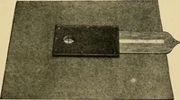 An illustration from Localization by X-rays and stereoscopy (1916)