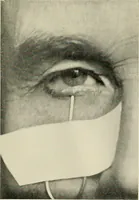 An illustration from Localization by X-rays and stereoscopy (1916)