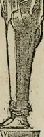 An illustration from Los emblemas de Alciato : traducidos en rhimas españolas ... (1549)