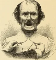 Picture 31 of 59 from Magnetismus und Hypnotismus; eine Darstellung dieses Gebietes, mit besonderer Berücksichtigung der Beziehungen zwischen dem mineralischen Magnetismus, dem sogenannten thierischen Magnetismus und dem Hypnotismus (1895), leaf 153
