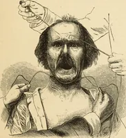 Picture 32 of 59 from Magnetismus und Hypnotismus; eine Darstellung dieses Gebietes, mit besonderer Berücksichtigung der Beziehungen zwischen dem mineralischen Magnetismus, dem sogenannten thierischen Magnetismus und dem Hypnotismus (1895), leaf 154