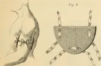 Picture 5 of 59 from Magnetismus und Hypnotismus; eine Darstellung dieses Gebietes, mit besonderer Berücksichtigung der Beziehungen zwischen dem mineralischen Magnetismus, dem sogenannten thierischen Magnetismus und dem Hypnotismus (1895), leaf 36