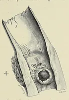 Picture 18 of 18 from Man and beast in eastern Ethiopia : from observations made in British East Africa, Uganda, and the Sudan (1911), leaf 419