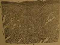 An illustration from Manual de anatomía patológica general : seguida de un resumen de microscopia aplicada a la histología y bacteriología patológicas (1896)