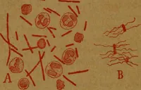 An illustration from Manual de anatomía patológica general : seguida de un resumen de microscopia aplicada a la histología y bacteriología patológicas (1896)