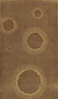 An illustration from Manual de anatomía patológica general : seguida de un resumen de microscopia aplicada a la histología y bacteriología patológicas (1896)