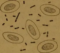 An illustration from Manual de anatomía patológica general : seguida de un resumen de microscopia aplicada a la histología y bacteriología patológicas (1896)