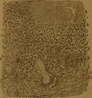 An illustration from Manual de anatomía patológica general : seguida de un resumen de microscopia aplicada a la histología y bacteriología patológicas (1896)
