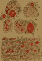 An illustration from Manual de anatomía patológica general : seguida de un resumen de microscopia aplicada a la histología y bacteriología patológicas (1896)