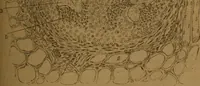 An illustration from Manual de anatomía patológica general : seguida de un resumen de microscopia aplicada a la histología y bacteriología patológicas (1896)