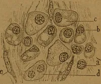 An illustration from Manual de anatomía patológica general : seguida de un resumen de microscopia aplicada a la histología y bacteriología patológicas (1896)