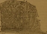 An illustration from Manual de anatomía patológica general : seguida de un resumen de microscopia aplicada a la histología y bacteriología patológicas (1896)