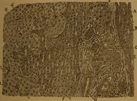 An illustration from Manual de anatomía patológica general : seguida de un resumen de microscopia aplicada a la histología y bacteriología patológicas (1896)