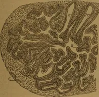 An illustration from Manual de anatomía patológica general : seguida de un resumen de microscopia aplicada a la histología y bacteriología patológicas (1896)
