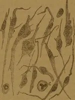 An illustration from Manual de anatomía patológica general : seguida de un resumen de microscopia aplicada a la histología y bacteriología patológicas (1896)