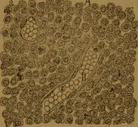 An illustration from Manual de anatomía patológica general : seguida de un resumen de microscopia aplicada a la histología y bacteriología patológicas (1896)
