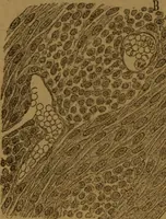 An illustration from Manual de anatomía patológica general : seguida de un resumen de microscopia aplicada a la histología y bacteriología patológicas (1896)