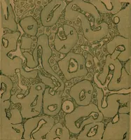 An illustration from Manual de anatomía patológica general : seguida de un resumen de microscopia aplicada a la histología y bacteriología patológicas (1896)
