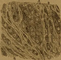 An illustration from Manual de anatomía patológica general : seguida de un resumen de microscopia aplicada a la histología y bacteriología patológicas (1896)