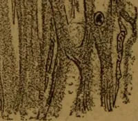 An illustration from Manual de anatomía patológica general : seguida de un resumen de microscopia aplicada a la histología y bacteriología patológicas (1896)
