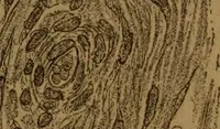 An illustration from Manual de anatomía patológica general : seguida de un resumen de microscopia aplicada a la histología y bacteriología patológicas (1896)