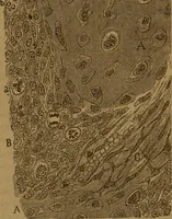 An illustration from Manual de anatomía patológica general : seguida de un resumen de microscopia aplicada a la histología y bacteriología patológicas (1896)