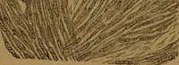 An illustration from Manual de anatomía patológica general : seguida de un resumen de microscopia aplicada a la histología y bacteriología patológicas (1896)