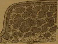 An illustration from Manual de anatomía patológica general : seguida de un resumen de microscopia aplicada a la histología y bacteriología patológicas (1896)