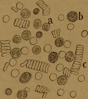 An illustration from Manual de anatomía patológica general : seguida de un resumen de microscopia aplicada a la histología y bacteriología patológicas (1896)