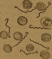 An illustration from Manual de anatomía patológica general : seguida de un resumen de microscopia aplicada a la histología y bacteriología patológicas (1896)