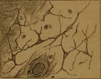 An illustration from Manual de anatomía patológica general : seguida de un resumen de microscopia aplicada a la histología y bacteriología patológicas (1896)