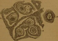 An illustration from Manual de anatomía patológica general : seguida de un resumen de microscopia aplicada a la histología y bacteriología patológicas (1896)
