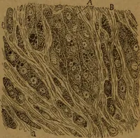 An illustration from Manual de anatomía patológica general : seguida de un resumen de microscopia aplicada a la histología y bacteriología patológicas (1896)