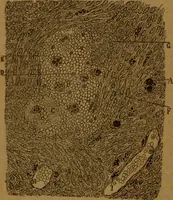 An illustration from Manual de anatomía patológica general : seguida de un resumen de microscopia aplicada a la histología y bacteriología patológicas (1896)