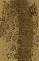 An illustration from Manual de anatomía patológica general : seguida de un resumen de microscopia aplicada a la histología y bacteriología patológicas (1896)