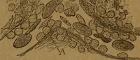 An illustration from Manual de anatomía patológica general : seguida de un resumen de microscopia aplicada a la histología y bacteriología patológicas (1896)