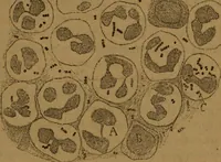 An illustration from Manual de anatomía patológica general : seguida de un resumen de microscopia aplicada a la histología y bacteriología patológicas (1896)