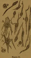 An illustration from Manual de anatomía patológica general : seguida de un resumen de microscopia aplicada a la histología y bacteriología patológicas (1896)