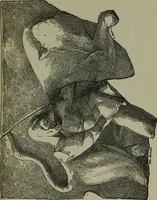 An illustration from A manual of Greek archaeology (1886)